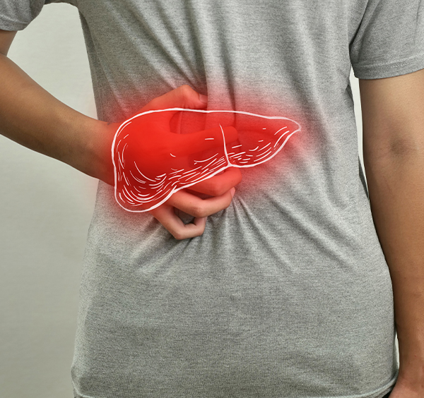 Steatoza hepatică (ficat gras) – cauze, simptome și tratament